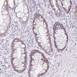 DTX4 Antibody, Novus Biologicals 25 &mu;L, Unlabeled:Antibodies, Polyclonal